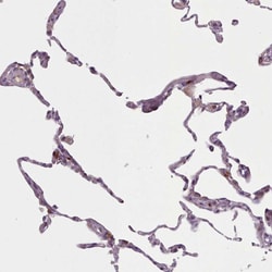 Invitrogen LAPTM5 Polyclonal Antibody 100 &mu;L; Unconjugated:Antibodies,