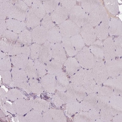 Invitrogen LAPTM5 Polyclonal Antibody 100 &mu;L; Unconjugated:Antibodies,