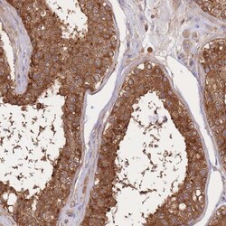 Invitrogen SLC4A9 Polyclonal Antibody 100 &mu;L; Unconjugated:Antibodies,
