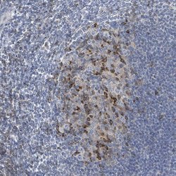 Invitrogen DGKZ Polyclonal Antibody 100 &mu;L; Unconjugated:Antibodies,