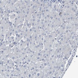 Invitrogen DGKZ Polyclonal Antibody 100 &mu;L; Unconjugated:Antibodies,