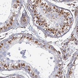 Invitrogen AGAP1 Polyclonal Antibody 100 &mu;L; Unconjugated:Antibodies,