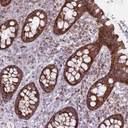 Invitrogen ALKBH4 Polyclonal Antibody 100 &mu;L; Unconjugated:Antibodies,