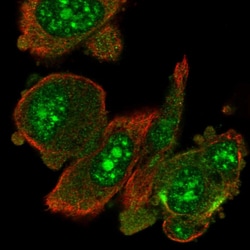 Invitrogen RIOK1 Polyclonal Antibody 100 &mu;L; Unconjugated:Antibodies,