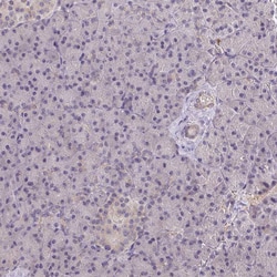Invitrogen RIOK1 Polyclonal Antibody 100 &mu;L; Unconjugated:Antibodies,