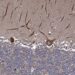 Invitrogen RALGAPB Polyclonal Antibody 100 &mu;L; Unconjugated:Antibodies,