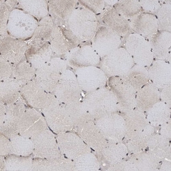 Invitrogen RALGAPB Polyclonal Antibody 100 &mu;L; Unconjugated:Antibodies,