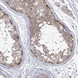 Invitrogen RALGAPB Polyclonal Antibody 100 &mu;L; Unconjugated:Antibodies,