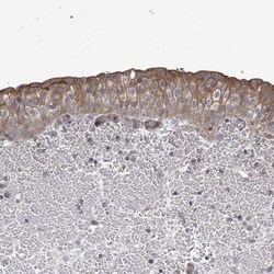 Invitrogen RALGAPB Polyclonal Antibody 100 &mu;L; Unconjugated:Antibodies,
