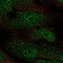 Invitrogen Annexin 2 Receptor Polyclonal Antibody 100 &mu;L; Unconjugated:Antibodies