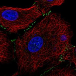 Invitrogen SLC26A9 Polyclonal Antibody 100 &mu;L; Unconjugated:Antibodies,