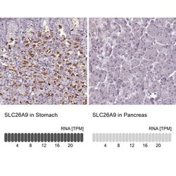 Invitrogen SLC26A9 Polyclonal Antibody 100 &mu;L; Unconjugated:Antibodies,