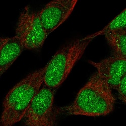Invitrogen ZNF280C Polyclonal Antibody 100 &mu;L; Unconjugated:Antibodies,