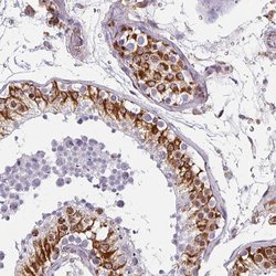 Invitrogen ZNF280C Polyclonal Antibody 100 &mu;L; Unconjugated:Antibodies,