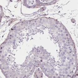 Invitrogen PLD4 Polyclonal Antibody 100 &mu;L; Unconjugated:Antibodies,