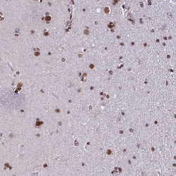 Invitrogen TIMM21 Polyclonal Antibody 100 &mu;L; Unconjugated:Antibodies,