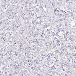 Invitrogen KCNE2 Polyclonal Antibody 100 &mu;L; Unconjugated:Antibodies,