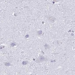 Invitrogen KCNE2 Polyclonal Antibody 100 &mu;L; Unconjugated:Antibodies,