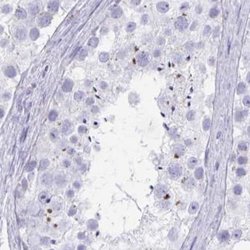 Invitrogen KCNE2 Polyclonal Antibody 100 &mu;L; Unconjugated:Antibodies,