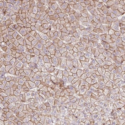 Invitrogen RIC1 Polyclonal Antibody 100 &mu;L; Unconjugated:Antibodies,