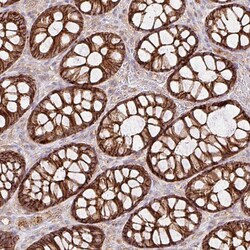 Invitrogen RIC1 Polyclonal Antibody 100 &mu;L; Unconjugated:Antibodies,
