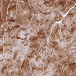 Invitrogen RIC1 Polyclonal Antibody 100 &mu;L; Unconjugated:Antibodies,