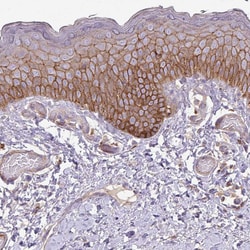 Invitrogen RIC1 Polyclonal Antibody 100 &mu;L; Unconjugated:Antibodies,