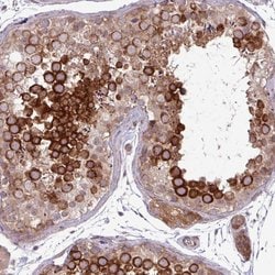 Invitrogen CNTRL Polyclonal Antibody 100 &mu;L; Unconjugated:Antibodies,