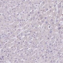 Invitrogen PPP1R35 Polyclonal Antibody 100 &mu;L; Unconjugated:Antibodies,
