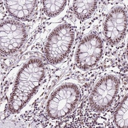 Invitrogen LUC7L2 Polyclonal Antibody 100 &mu;L; Unconjugated:Antibodies,