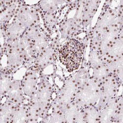 Invitrogen LUC7L2 Polyclonal Antibody 100 &mu;L; Unconjugated:Antibodies,