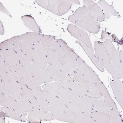 Invitrogen LUC7L2 Polyclonal Antibody 100 &mu;L; Unconjugated:Antibodies,
