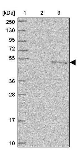 Invitrogen PUS1 Polyclonal Antibody 100 &mu;L; Unconjugated:Antibodies,