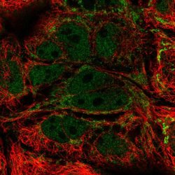 Invitrogen MRPL21 Polyclonal Antibody 100 &mu;L; Unconjugated:Antibodies,
