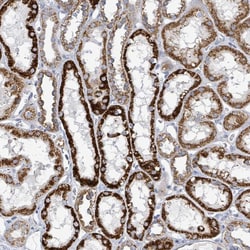 Invitrogen ALG12 Polyclonal Antibody 100 &mu;L; Unconjugated:Antibodies,