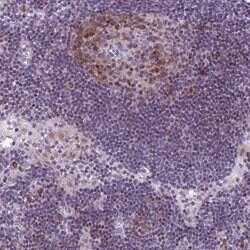 Invitrogen PQLC1 Polyclonal Antibody 100 &mu;L; Unconjugated:Antibodies,