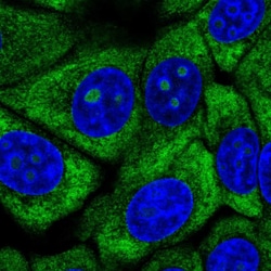 Invitrogen RPL13 Polyclonal Antibody 100 &mu;L; Unconjugated:Antibodies,