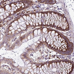 Invitrogen RPL13 Polyclonal Antibody 100 &mu;L; Unconjugated:Antibodies,
