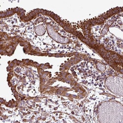 Invitrogen RPL13 Polyclonal Antibody 100 &mu;L; Unconjugated:Antibodies,