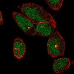 Invitrogen TTC30A Polyclonal Antibody 100 &mu;L; Unconjugated:Antibodies,