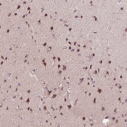 Invitrogen CHMP4B Polyclonal Antibody 100 &mu;L; Unconjugated:Antibodies,