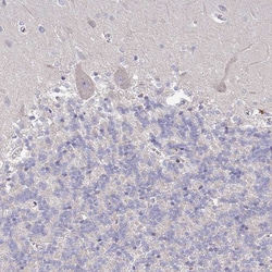 Invitrogen RPL23A Polyclonal Antibody 100 &mu;L; Unconjugated:Antibodies,