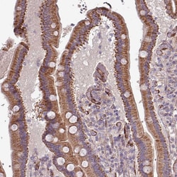 Invitrogen RPL23A Polyclonal Antibody 100 &mu;L; Unconjugated:Antibodies,