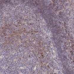Invitrogen RPL23A Polyclonal Antibody 100 &mu;L; Unconjugated:Antibodies,