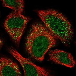 Invitrogen ACBD4 Polyclonal Antibody 100 &mu;L | Buy Online | Invitrogen&trade; | Fisher Scientific