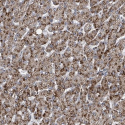 Invitrogen ACBD4 Polyclonal Antibody 100 &mu;L | Buy Online | Invitrogen&trade; | Fisher Scientific
