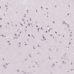 Invitrogen Smoothelin Polyclonal Antibody 100 &mu;L; Unconjugated:Antibodies,