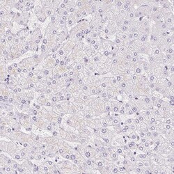 Invitrogen Smoothelin Polyclonal Antibody 100 &mu;L; Unconjugated:Antibodies,