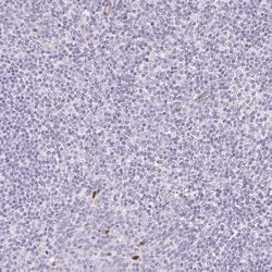 Invitrogen Smoothelin Polyclonal Antibody 100 &mu;L; Unconjugated:Antibodies,