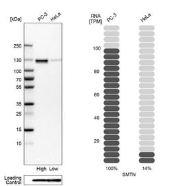 Invitrogen Smoothelin Polyclonal Antibody 100 &mu;L; Unconjugated:Antibodies,